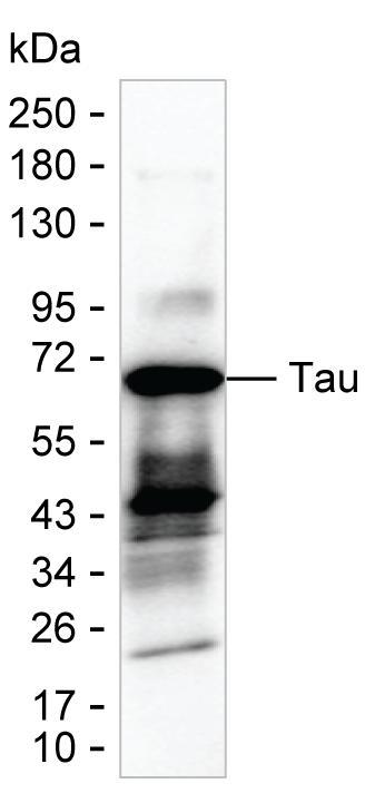 Tau